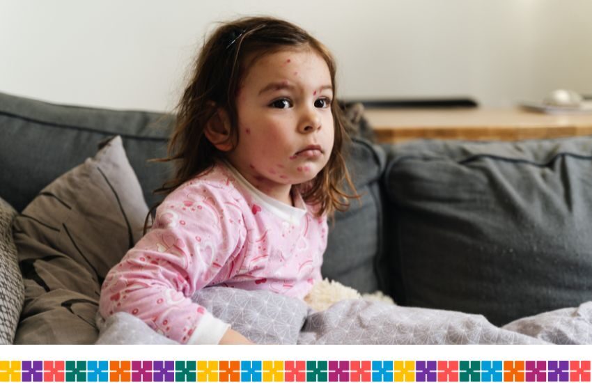 Young child sad with chickenpox